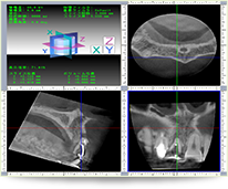 歯科用CTで精密検査や模型による診断