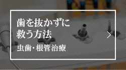 歯を抜かずに救う方法虫歯・根管治療